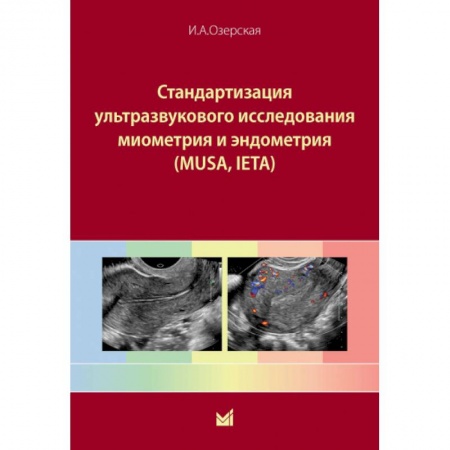 УЗИ. ЭКГ. Томография. Рентген, книга Стандартизация ультразвукового исследования миометрия и эндометрия (MUSA, IETA) купить по скидке