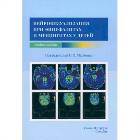 Отдельные виды заболеваний у детей, книга Нейровизуализация при энцефалитах и менингитах у детей купить по скидке