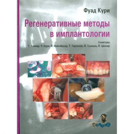 Стоматология, книга Регенеративные методы в имплантологии купить по скидке