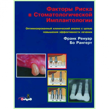 Стоматология, книга Факторы риска в стоматологической имплантологии. купить по скидке