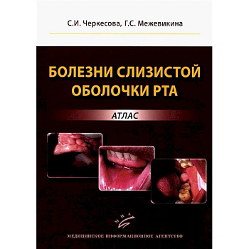 Болезни слизистой оболочки рта: атлас Болезни слизистой оболочки рта: атлас