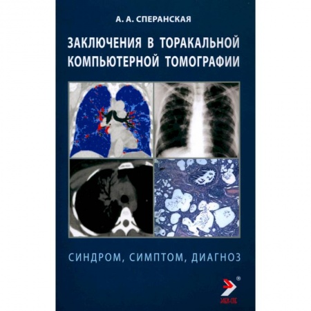 Другие виды специальной медицины, книга Заключение в таракальной компьютерной  томографии. Симптом, синдром, диагноз. купить по скидке