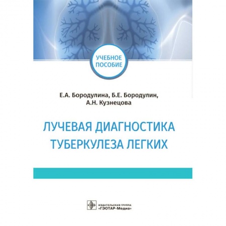 Терапия. Пульмонология, книга Лучевая диагностика туберкулеза легких купить по скидке