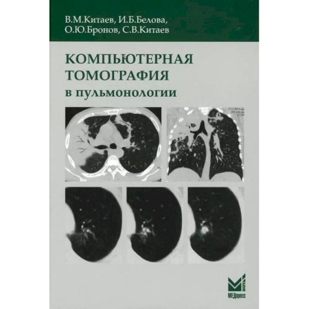 Другие виды специальной медицины, книга Компьютерная томография в пульмонологии купить по скидке