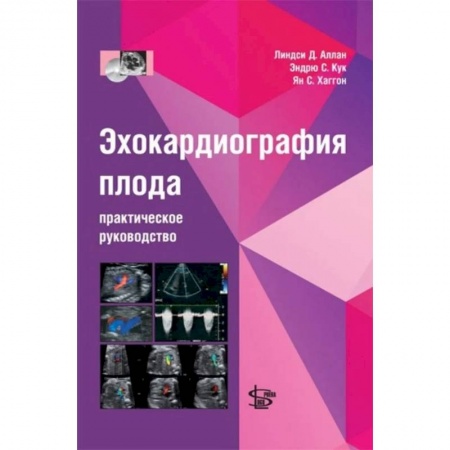 Медицинские энциклопедии и справочники, книга Эхокардиография плода: практическое руководство. + DVD купить по скидке
