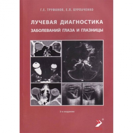 Специальная медицина, книга Лучевая диагностика заболеваний глаза и глазницы купить по скидке
