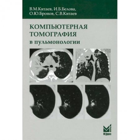Другие виды специальной медицины, книга Компьютерная томография в пульмонологии купить по скидке