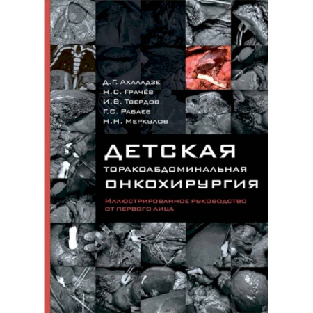 Онкология, книга Детская торакоабдоминальная онкохирургия. Иллюстрированное руководство от первого лица купить по скидке