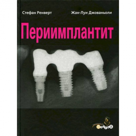 Стоматология, книга Периимплантит купить по скидке
