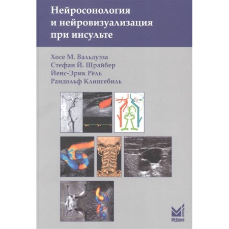 Специальная медицина, книга Нейросонология и нейровизуализация при инсульте купить по скидке