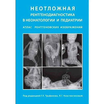 Неотложная рентгенодиагностика в неонатологии и педиатрии Неотложная рентгенодиагностика в неонатологии и педиатрии