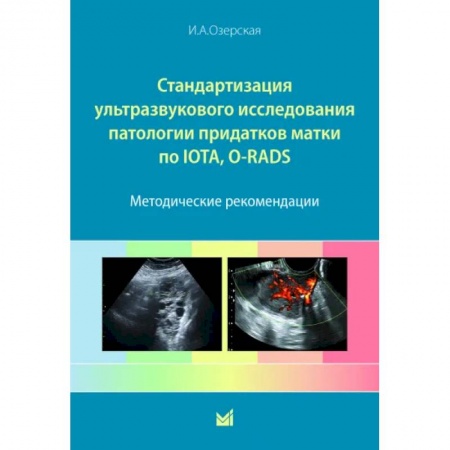 УЗИ. ЭКГ. Томография. Рентген, книга Стандартизация ультразвукового исследования патологии придатков матки по IOTA, O-RADS купить по скидке