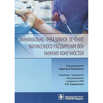 Минимально инвазивное лечение варикозного расширения вен Минимально инвазивное лечение варикозного расширения вен
