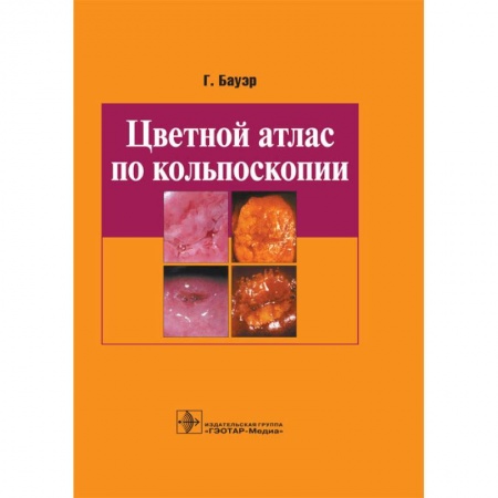 Акушерство и гинекология, книга Цветной атлас по кольпоскопии купить по скидке