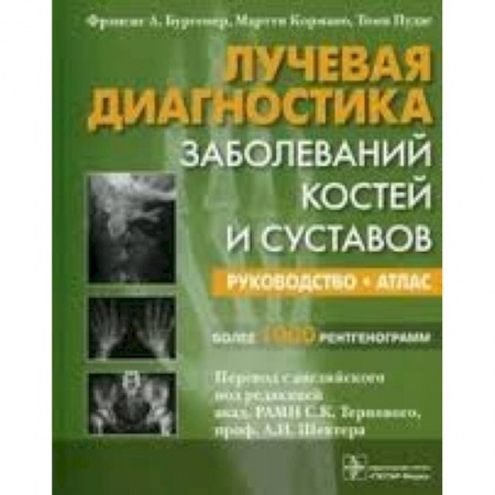 Диагностика. Методы и виды, книга Лучевая диагностика заболеваний костей и суставов купить по скидке