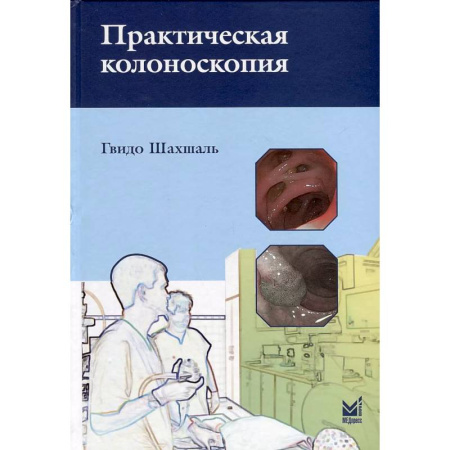 Медицинские энциклопедии и справочники, книга Практическая колоноскопия. Методика, рекомендации, советы и приемы купить по скидке