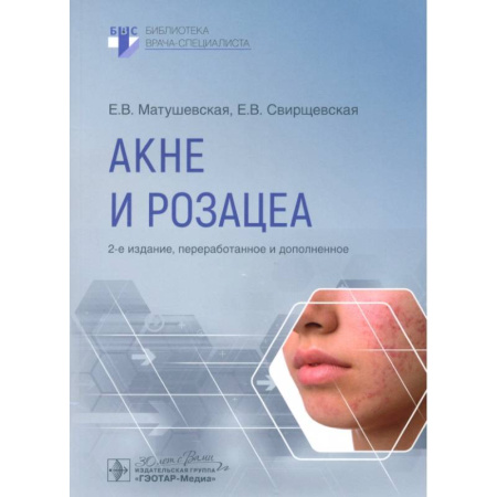 Кожные и венерические болезни, книга Акне и розацеа купить по скидке