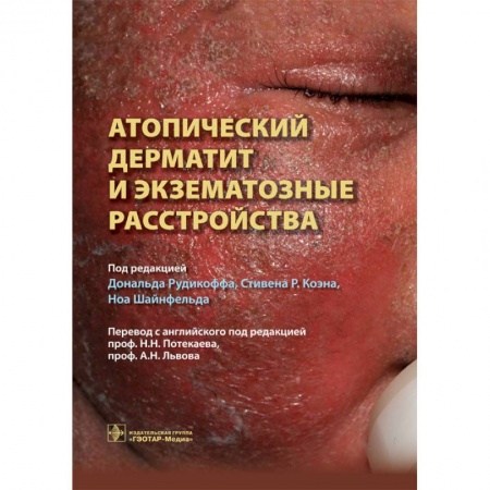 Книги, книга Атопический дерматит и экзематозные расстройства купить по скидке