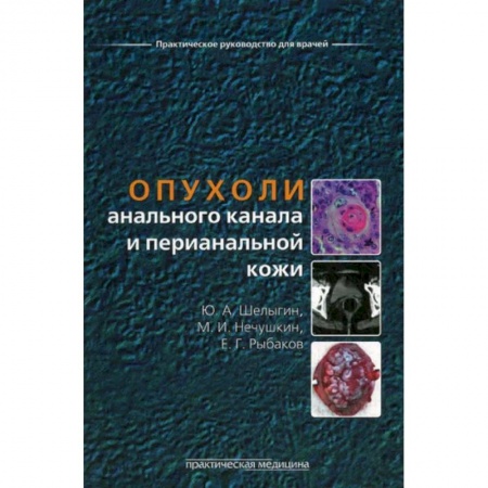 Онкология, книга Опухоли анального канала и перианальной кожи купить по скидке