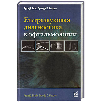 Ультразвуковая диагностика в офтальмологии Ультразвуковая диагностика в офтальмологии