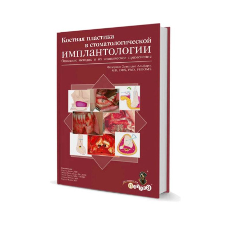 Стоматология, книга Костная пластика в стоматологической имплантологии. Описание методик и их клинического применения купить по скидке