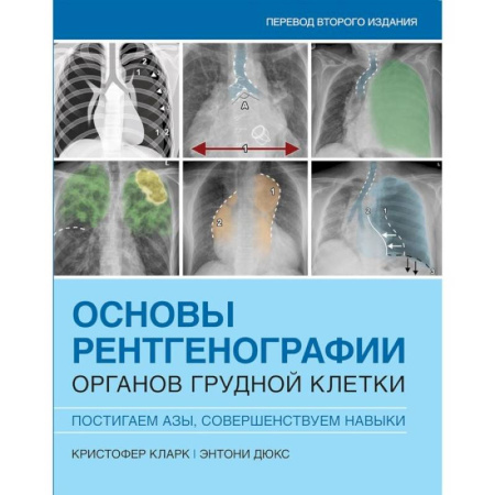 Другие виды специальной медицины, книга Основы рентгенографии органов грудной клетки купить по скидке