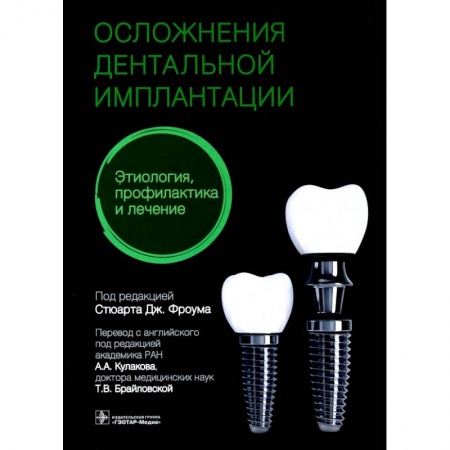 Стоматология, книга Осложнения дентальной имплантации.Этиология,профилактика и лечение купить по скидке
