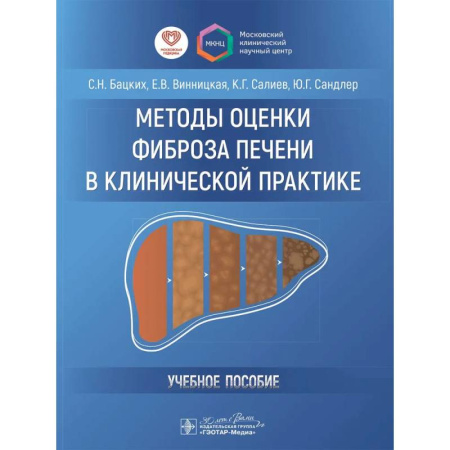 Гастроэнтерология, книга Методы оценки фиброза печени в клинической практике купить по скидке