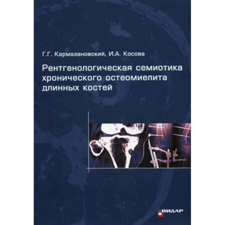УЗИ. ЭКГ. Томография. Рентген, книга Рентгенологическая семиотика хронического остеомиелита длинных костей купить по скидке