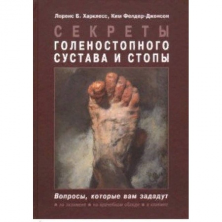 Хирургия. Ортопедия, книга Секреты голеностопного сустава и стопы купить по скидке