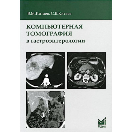 УЗИ. ЭКГ. Томография. Рентген, книга Компьютерная томография в гастроэнтерологии: руководство для врачей. купить по скидке